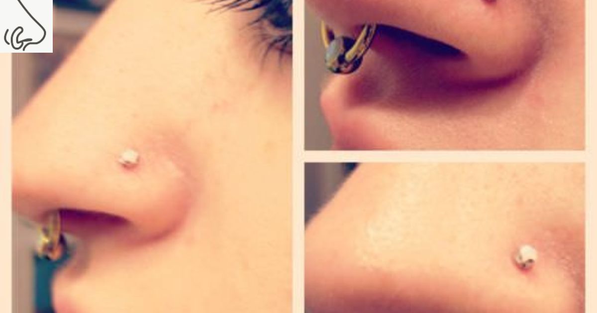  Can You Get Paralyzed from Piercing Your Nose?