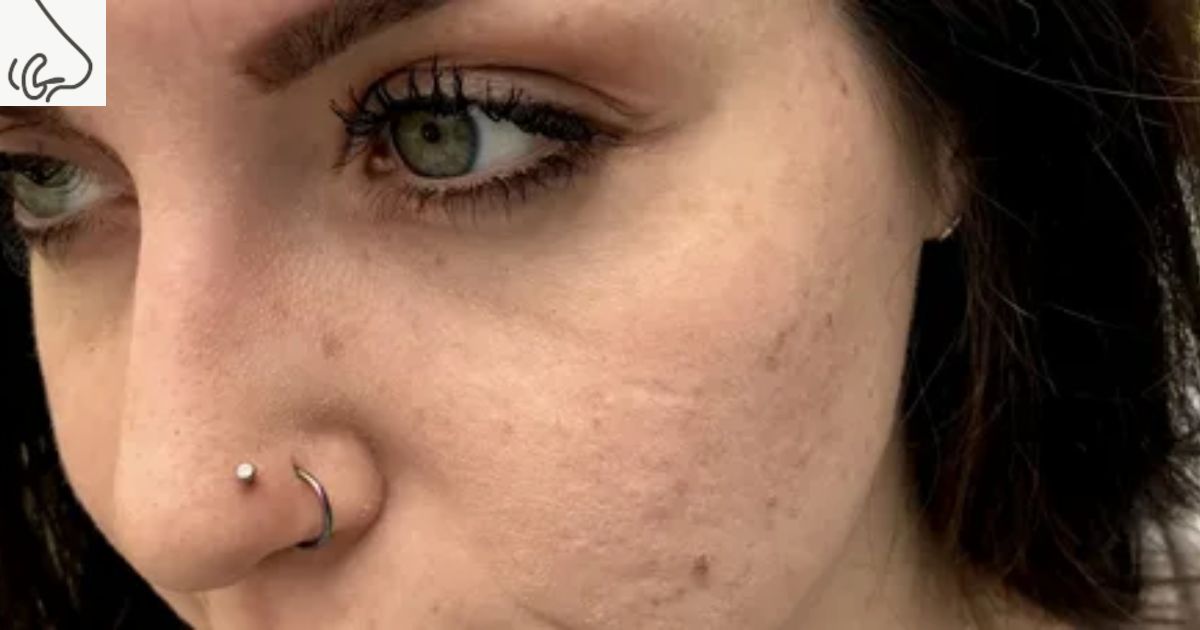 Can You Get Two Nose Piercings at Once? 
