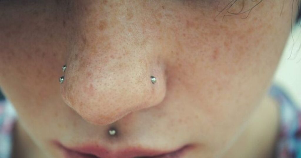 The Impact of Allergies on Nose Piercing Healing