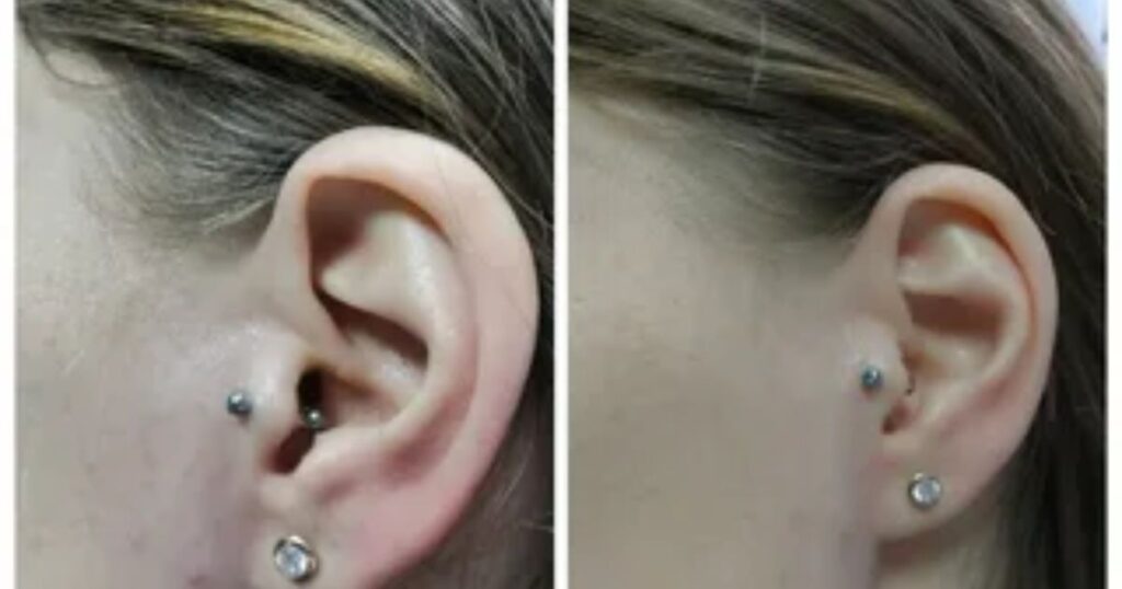 How to Change Out a Tragus Piercing 